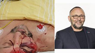 Germania: aggredito e ferito gravemente uno dei leader di AfD