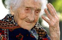 Alzheimer tedavisinde yeni umut: Gelişimi ilk belirtiler görülmeden yıllar önce izlenebilecek