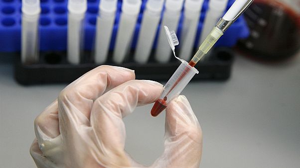 Singapur'da HIV taşıyan 14 bin 200 kişinin özel bilgileri internete sızdırıldı Singapur'da HIV taşıyan 14 bin 200 kişinin özel bilgileri internete sızdırıldı