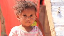 The ceasefire in Hodeida hasn't stopped bullets and starvation claiming Yemeni lives ǀ View
