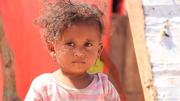 The ceasefire in Hodeida hasn't stopped bullets and starvation claiming Yemeni lives ǀ View