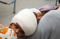 Se acerca el Día D para las siamesas de Bangladés