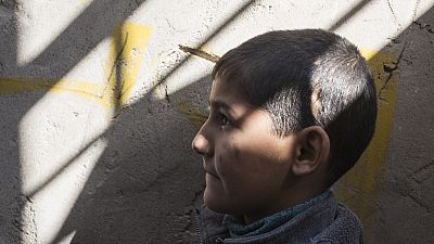 A child in Iraq who was struck in the head with shrapnel