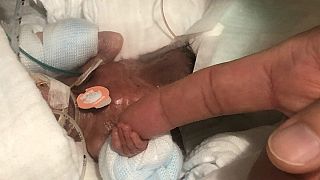 کوچکترین نوزاد پسر جهان صحیح و سالم از بیمارستان مرخص شد