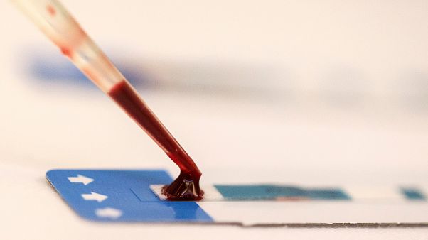 Médicos apontam para cura de segundo paciente com HIV Médicos apontam para cura de segundo paciente com HIV