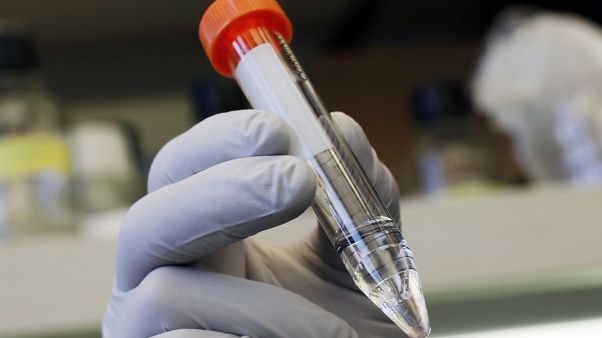 AIDS: másodszor is hatékony volt az őssejtkezelés AIDS: másodszor is hatékony volt az őssejtkezelés