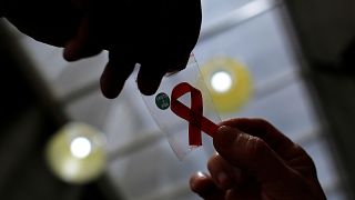 Segundo paciente sin rastros de VIH tras un transplante de células