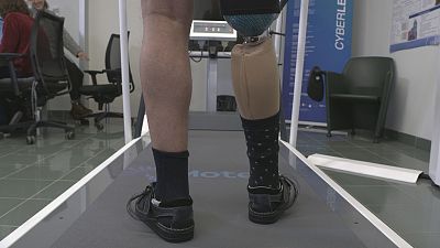 Itália desenvolve pernas robóticas