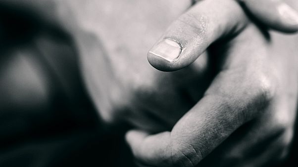 السبب العلمي وراء صوت فرقعة اليدين المفاصل السبب العلمي وراء صوت فرقعة اليدين المفاصل