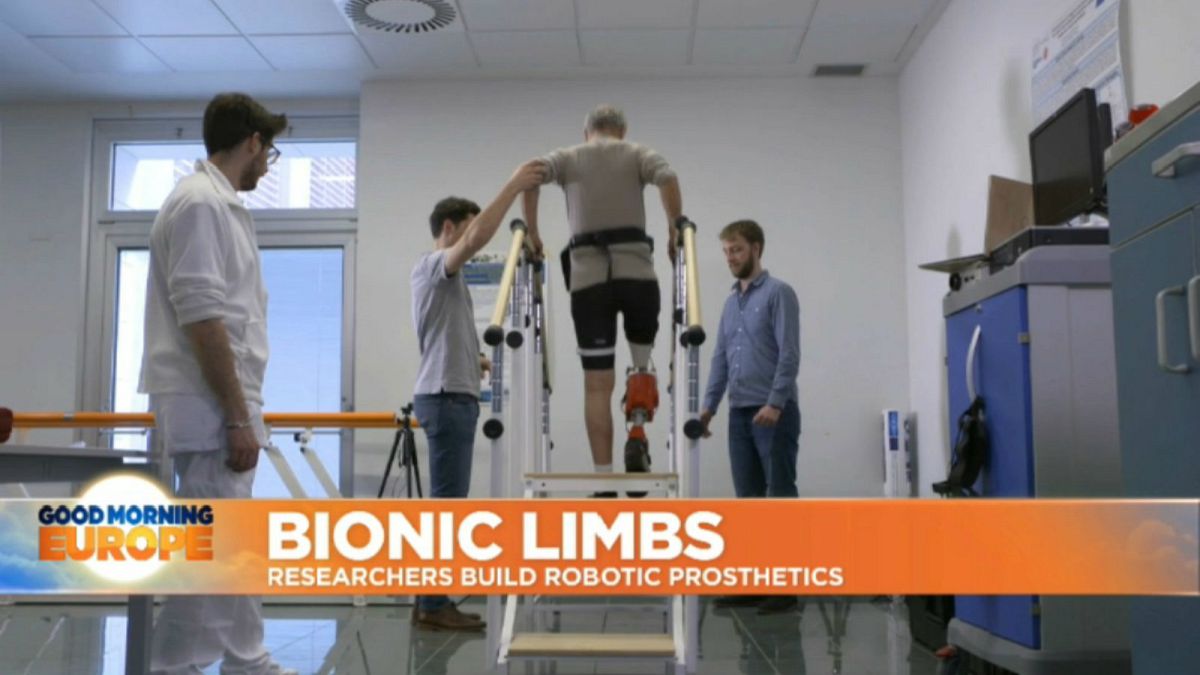 EU-funded prosthesis aims to make life easier for amputees