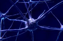 في سابقة  من نوعها: علماء يتمكنون من صناعة دماغ مصغر في طبق التجارب