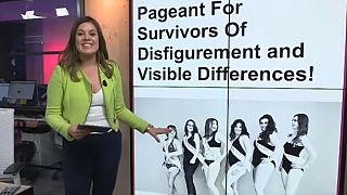 Unique beauty pageant launches for survivors of disfigurement | #TheCube