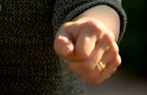 Seltene Mutation: Schottin kennt keinen Schmerz