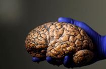 باحث بلجيكي يحمل مخا بشريا