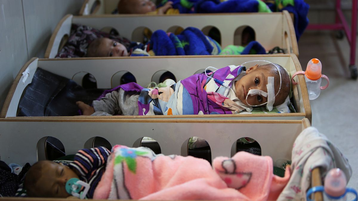 شاهد: أطفال داعش يتضورون جوعا ونسائهم جريحات بمستشفيات سورية
