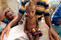 A malnourished girl sits on her father's lap in Hodeidah, Yemen