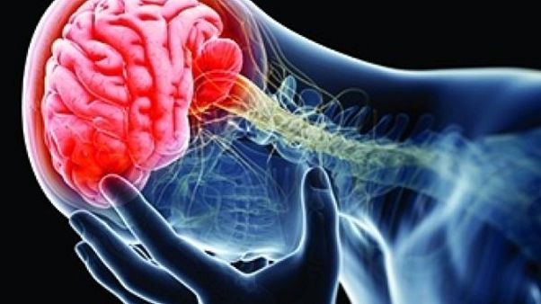 LATE: Alzheimer'a çok benzeyen ancak farklı nedenlere sahip olan bunama hastalığı LATE: Alzheimer'a çok benzeyen ancak farklı nedenlere sahip olan bunama hastalığı