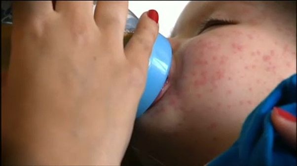 Alemanha quer multar quem não vacinar crianças contra sarampo Alemanha quer multar quem não vacinar crianças contra sarampo