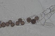 ماهو فطر المستشفيات القاتل الذي لايزال يرعب العالم منذ ظهوره في 2009