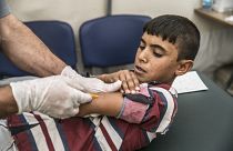 Sağlık Örgütü'nden Avrupa'ya kızamık uyarısı: İki ayda 34 bin vaka bildirildi