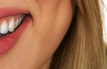 دراسة: بعض معاجين تبييض الأسنان قد تسبب السرطان