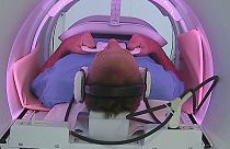 ديفيد هودسن خلال خضوعه للعلاج بواسطة آلة جديدة للتصوير بالرنين المغناطيسي