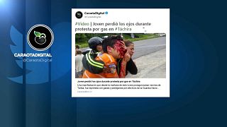 La tragedia del adolescente ciego por tiros de la Policía en Venezuela