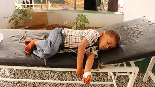 طفل يمني يتلقى العلاج في المستشفى