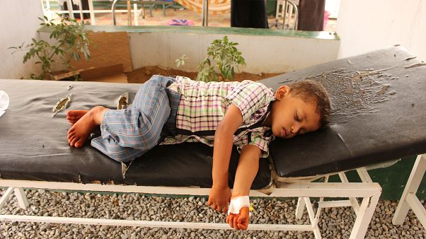 طفل يمني يتلقى العلاج في المستشفى طفل يمني يتلقى العلاج في المستشفى