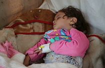 Au Yémen, l'épidémie de choléra touche massivement les enfants