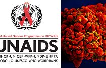 BM: 2018'de 770 bin kişi AIDS'ten hayatını kaybetti