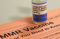Kötelező lesz Németországban a kanyaró elleni védőoltás