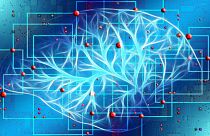 هوش مصنوعی امید به تشخیص سریع‌تر و دقیق‌تر سرطان‌ را افزایش می‌دهد