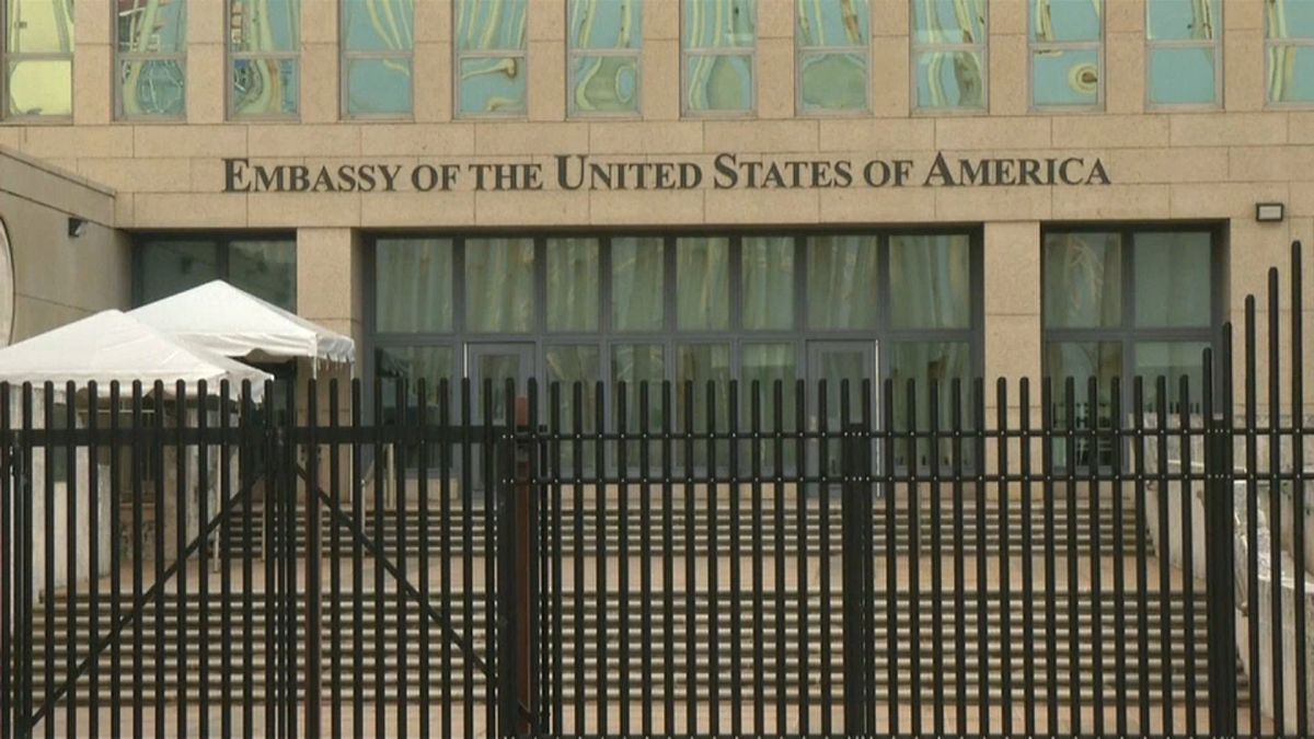 ABD-Küba ‘sonik saldırı' krizi: Diplomatların beyin tomografisinde 'somut farklılıklar' saptandı