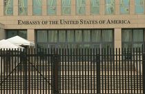 ABD-Küba ‘sonik saldırı' krizi: Diplomatların beyin tomografisinde 'somut farklılıklar' saptandı