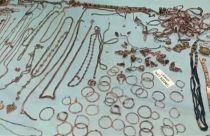 جانب من بعض الحليّ التي وجدها الأطباء في بطن سيدة هندية