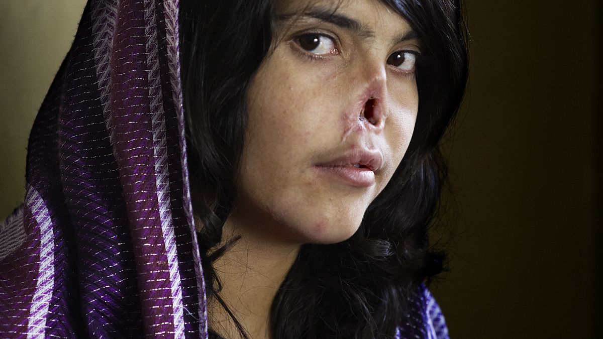 El retrato de Bibi Aisha, ganador del World Press Photo en 2010.