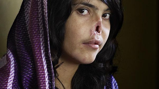 World Press Photo, solo 4 donne vincitrici in 64 anni: "Una professione dominata da uomini" World Press Photo, solo 4 donne vincitrici in 64 anni: "Una professione dominata da uomini"