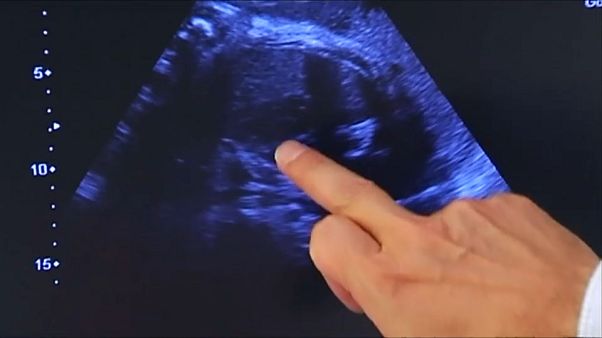 Tres nuevos abortos por casos de listeriosis en España Tres nuevos abortos por casos de listeriosis en España