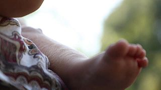 Ισπανία: Ετοιμάζουν μηνύσεις οι γονείς μωρών με «το σύνδρομο του λυκάνθρωπου»