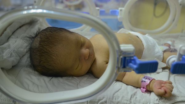 Cekya Beyin Olumu 117 Gun Once Gerceklesen Kadin Dogum Yapti Euronews