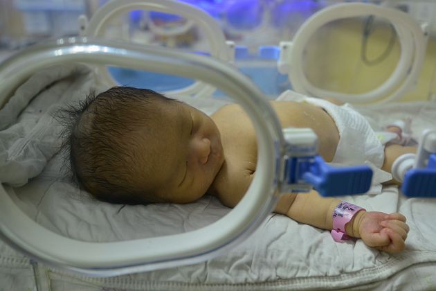 Çekya: Beyin ölümü 117 gün önce gerçekleşen kadın doğum yaptı