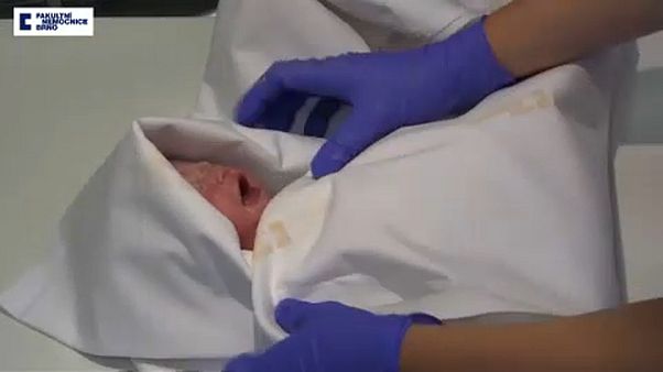 Egészséges a baba, akinek egy agyhalott anya adott életet Egészséges a baba, akinek egy agyhalott anya adott életet