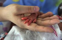 ABD'de bir hastanede kürtaj ile doğan bebeklere 'ölüm odaları' tahsis edildi