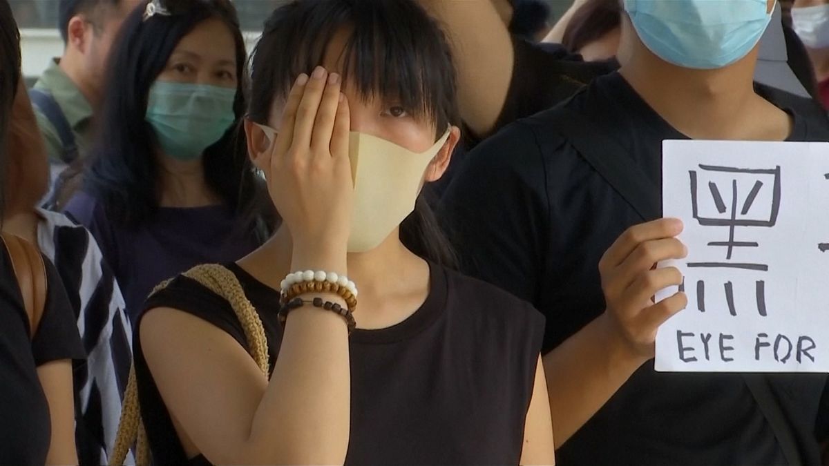 Apoyo masivo a Miss K, la enfermera hongkonesa que perdió un ojo