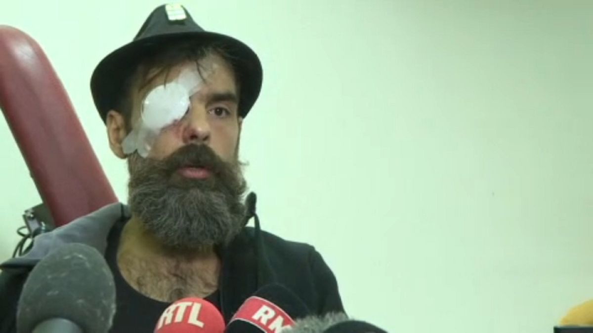 Yellow vest protester blames police after suffering serious eye injury