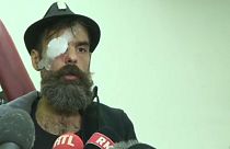 Yellow vest protester blames police after suffering serious eye injury