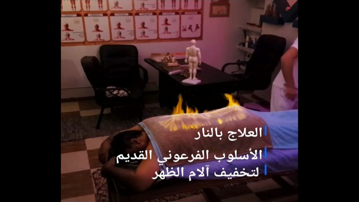 مصر: إن كنت تعاني من آلام الظهر.. فيمكنك علاجه بتقنية "التدليك الناري" 
