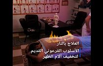 مصر: إن كنت تعاني من آلام الظهر.. فيمكنك علاجه بتقنية "التدليك الناري"