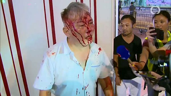 Χονγκ Κονγκ: 16ο Σαββατοκύριακο διαδηλώσεων Χονγκ Κονγκ: 16ο Σαββατοκύριακο διαδηλώσεων